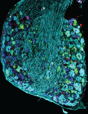 This image shows a section from a mouse dorsal root ganglion stained for Interferon Alpha and Beta Receptor Subunit 1 (mRNA; red) along with the sensory neuron markers calcitonin gene-related peptide (mRNA; green), purinergic receptor P2X3 (mRNA; blue) and Neurofilament-200 (protein; cyan).