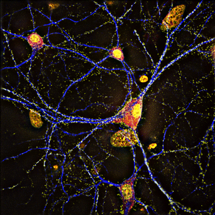 Three-dimensional deconvolved fluorescence image of cultured hippocampal neurons in which cellular components involved in synaptic activity, activity-dependent transcription, and synaptic plasticity are labeled