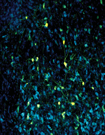 This image shows ventral striatal neurons from a rodent brain. The cell bodies are stained in blue using a fluorescent NISSL stain (NeuroTrace).