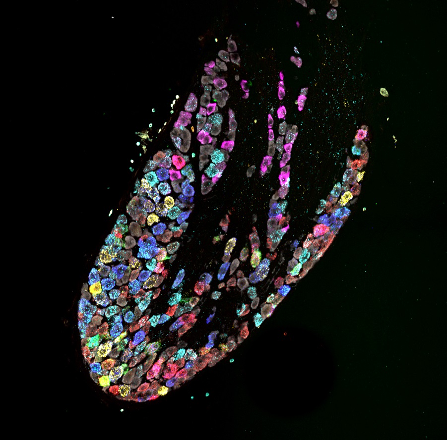 This image shows the emergence of cell type specific gene expression patterns in developing sensory neurons of the vagus nerve located in the nodose ganglion. 