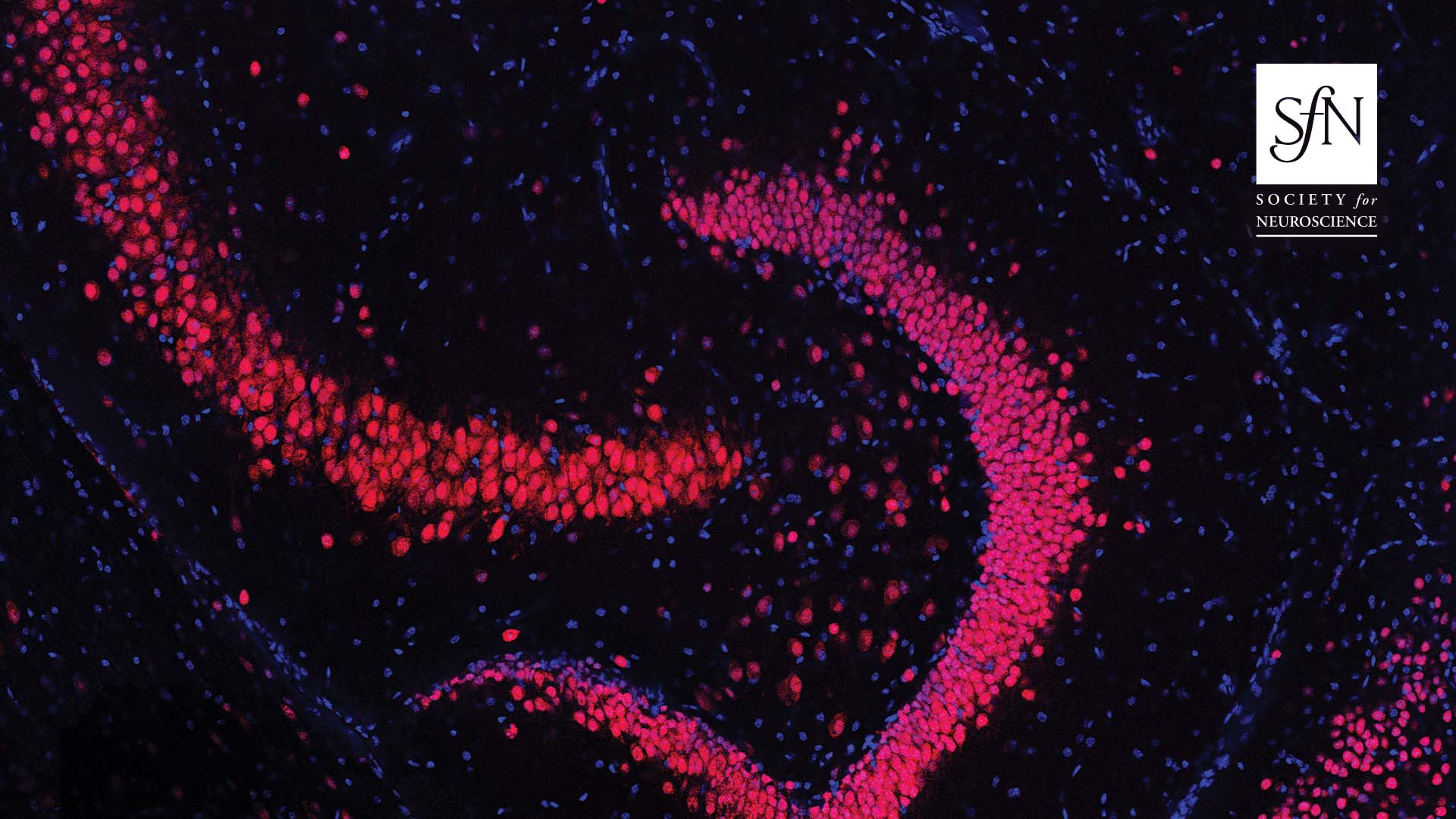 This image shows a slice of mouse hippocampus with a focus on the dentate gyrus. Blue (DAPI) identifies cell nuclei, and red staining (NeuN) identifies neurons. Changes in the activity of dentate granule cells that occur in a mouse model of temporal lobe epilepsy impair pattern separation at the neural level, which may explain memory deficits in these mice and in humans with this disorder. For more information see the article by Madar et al. (pages 9669–9686). Cover image: Jesse Pfammatter.