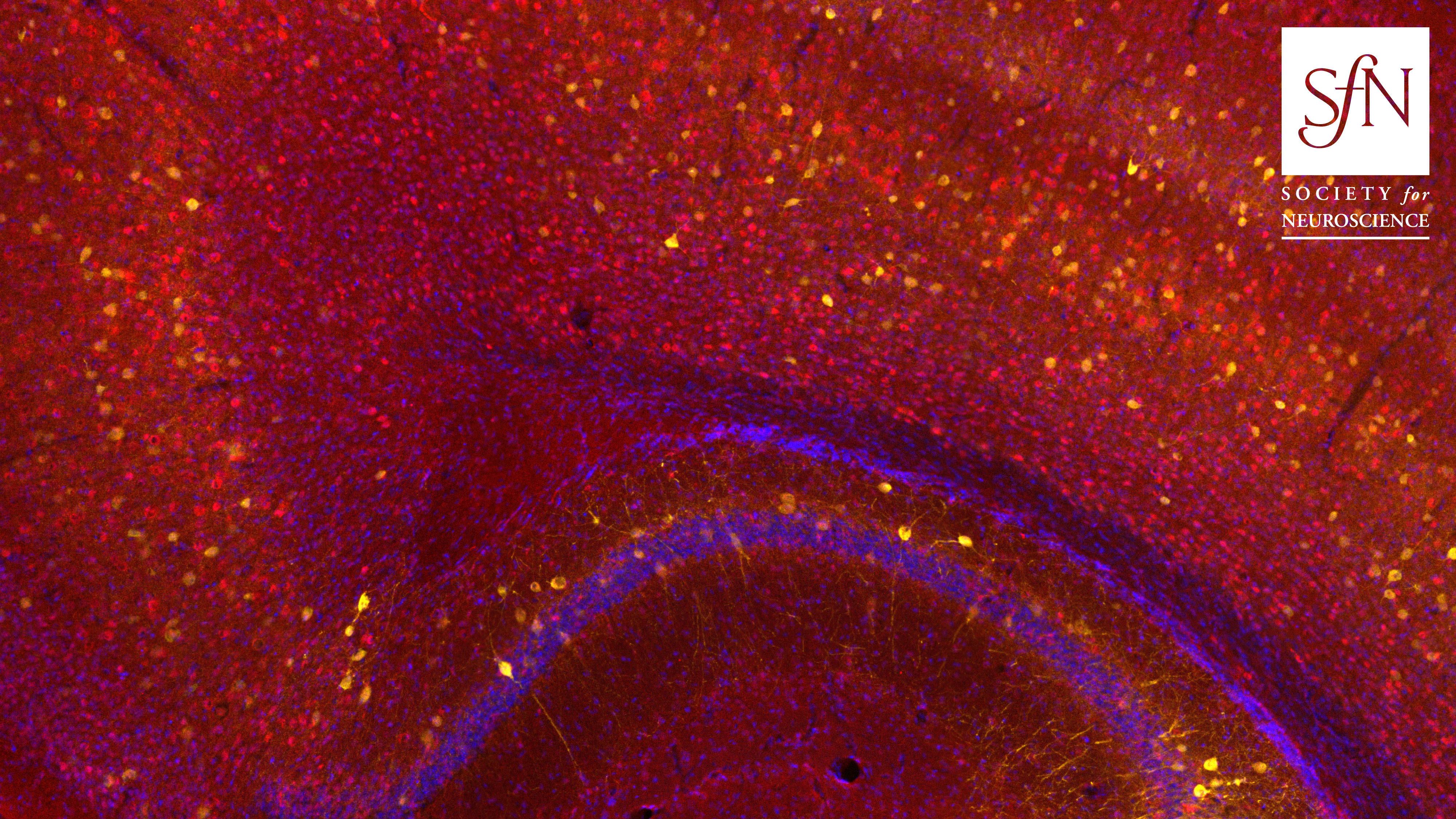 This image shows parvalbumin (yellow), β-catenin (red), and DAPI (blue) in an APC cKO mouse.