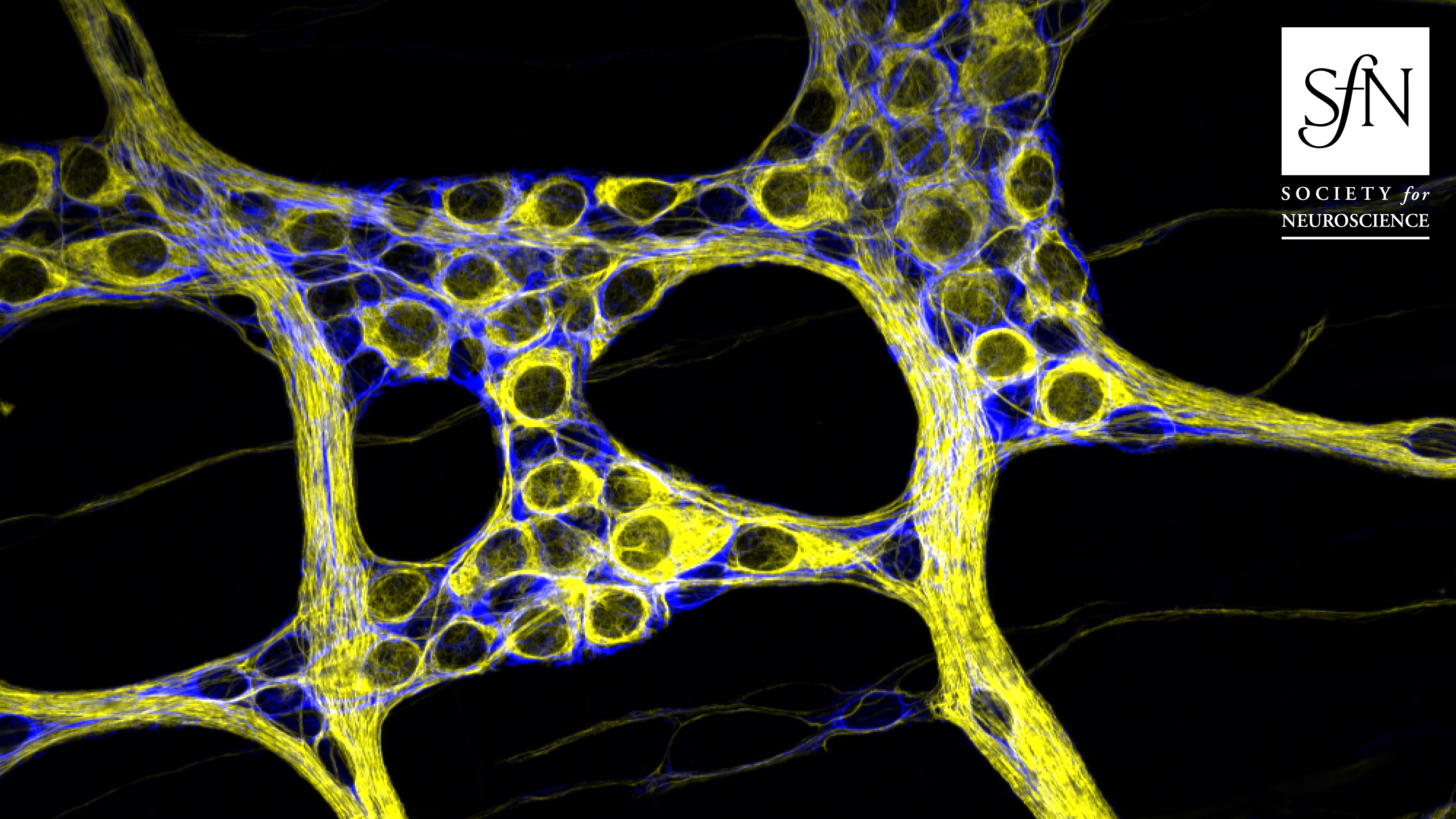 This image shows enteric neurons (identified with peripherin labeling, yellow) and glia (identified with GFAP labeling, blue) within a myenteric ganglion from the mouse colon.
