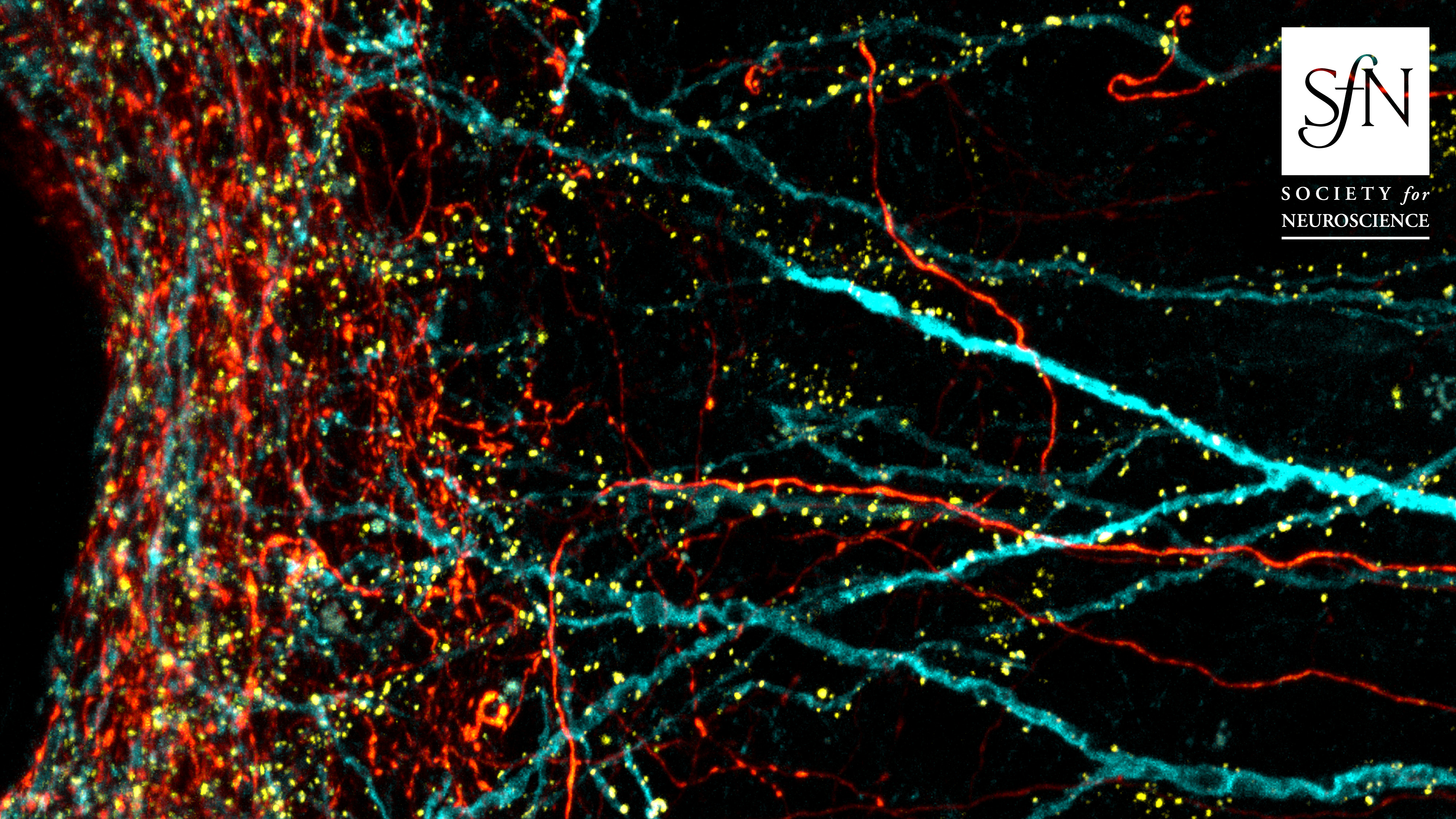 Superficial layers of mouse primary somatosensory cortex showing apical dendrites of L5 pyramidal neurons labeled with a cyan fluorescent protein (CFP)-cell fill, and excitatory post-synaptic sites marked by PSD95.FingR-Citrine (yellow).