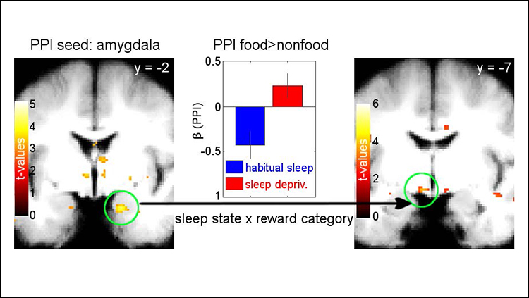 Unraveling the Link Between Obesity and Sleep