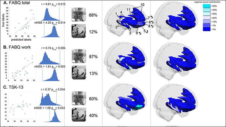 Brain Activity Predicts Fear of Pain