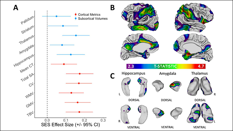 Socioeconomic Status and the Developing Brain