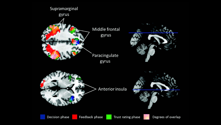 Ecstasy Ingredient May Promote Cooperation