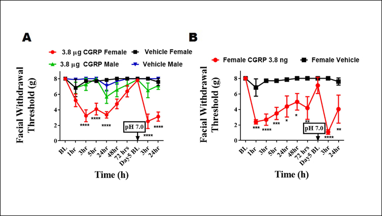 Migraine Neurobiology Linked to Prevalence in Females