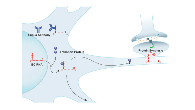 Lupus Antibody Target Identified