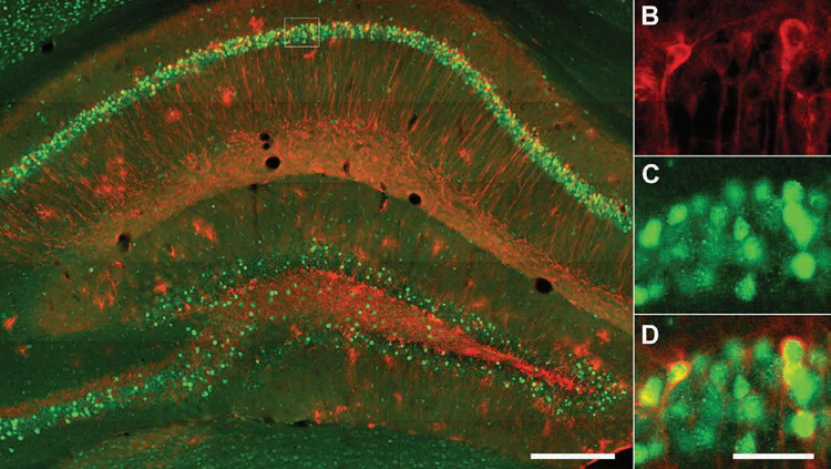 Negative Memory Storage Affects Depression Symptoms