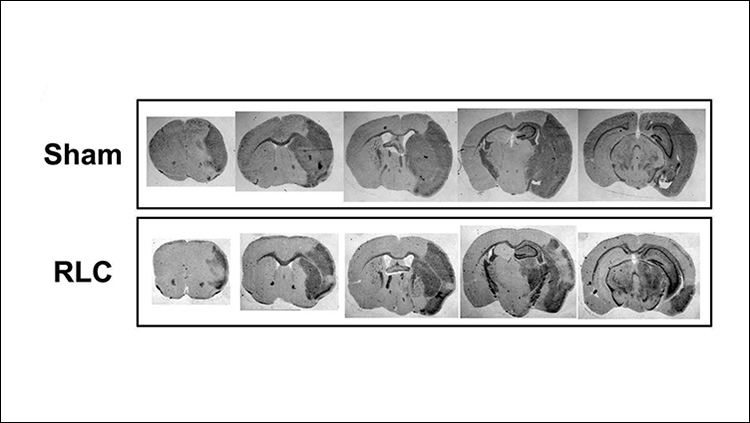 Regulating Blood Supply to Limbs Improves Stroke Recovery