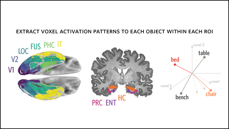 The link between drawing and seeing in the brain