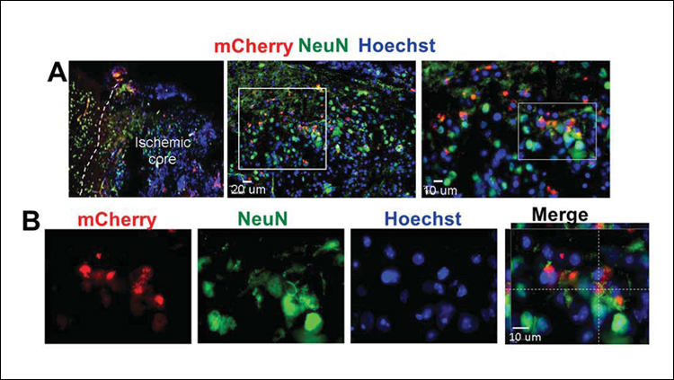 Stem Cell Stimulation Improves Stroke Recovery