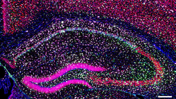 Targeting Microglia Using Cx3cr1-Cre Lines: Revisiting the Specificity