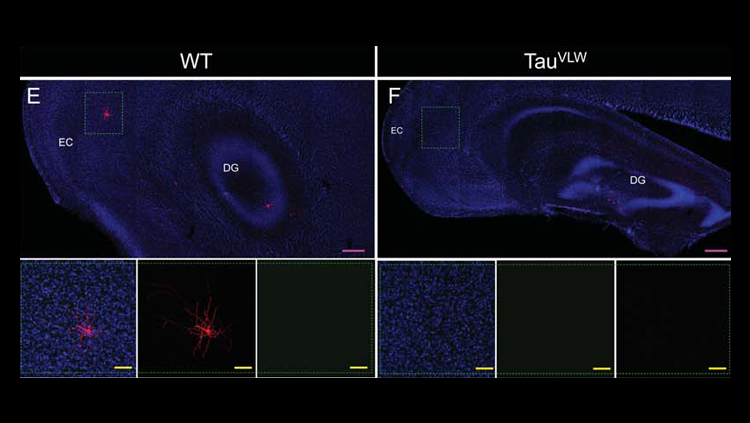 Broken brain cells repaired in dementia mouse model