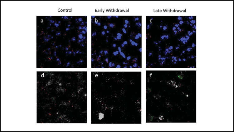 Diabetes drug relieves nicotine withdrawal