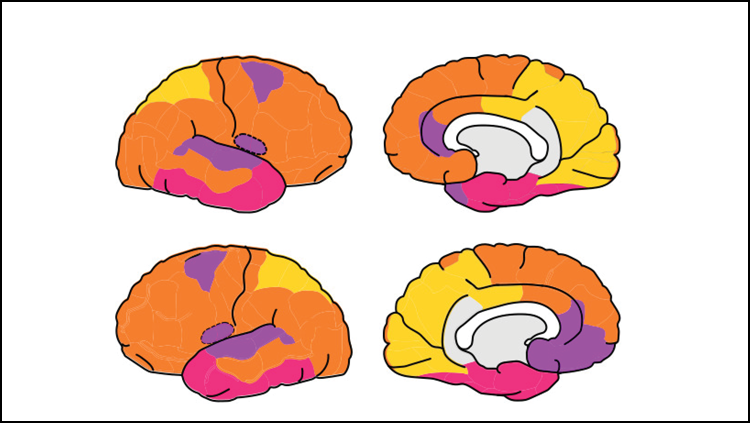 The fetal brain possesses adult-like networks
