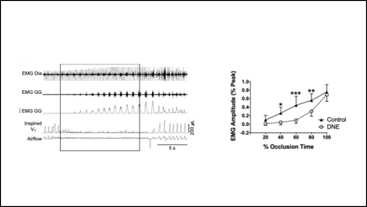 Fetal nicotine exposure harms breathing in infants