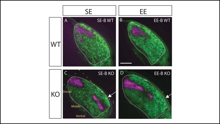 Environmental enrichment corrects errors in brain development