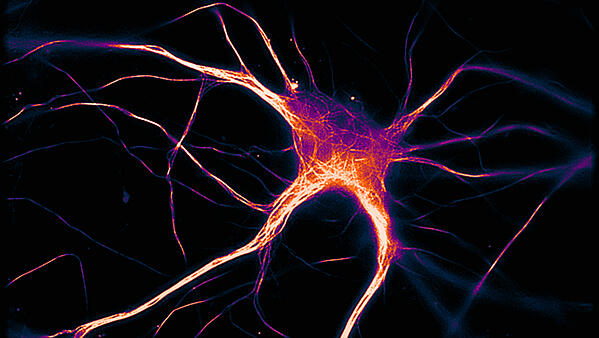 How Alzheimer's disease spreads through the brain