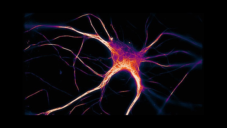 How Alzheimer's disease spreads through the brain
