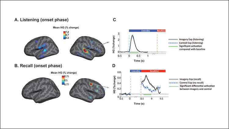 Watching music move through the brain