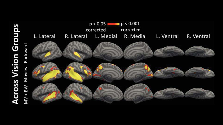 How the brain repurposes unused regions