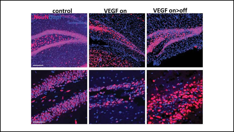 Six images of the dentate gyrus. The 2 on the left show the control. The middle two show over-expression of VEGF, which causes damage. The two on the right show after over-expression is turned off, and the dentate gyrus looks like the control.