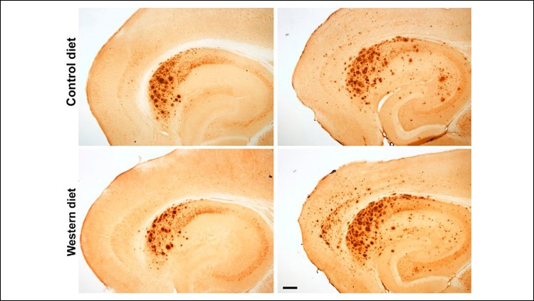 20190920_featured_review The impact of the control and Western diets on the brain is pictured here