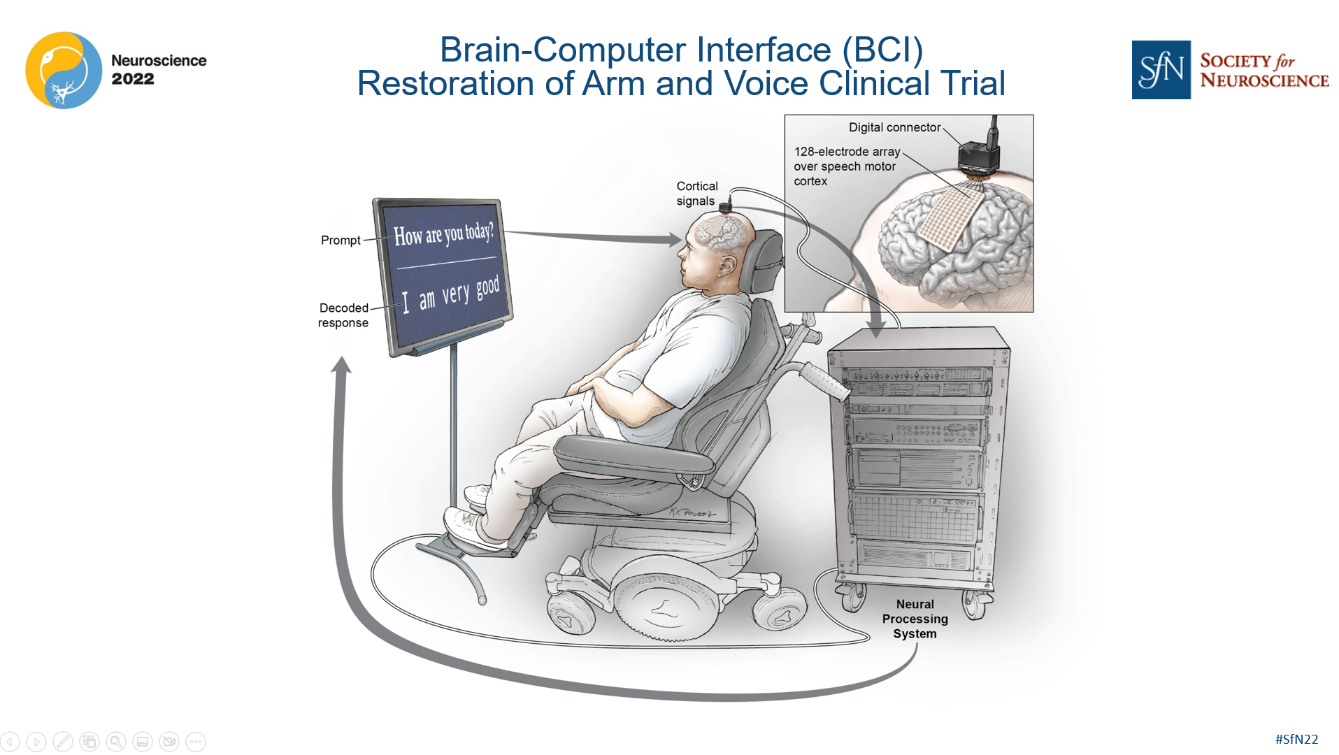 image showing the Brain-Computer Interface Restoration of Arm and Voice Clinical Trial