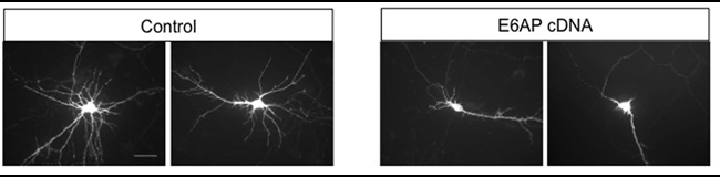 E6AP overexpression reduces the complexity of dendritic arborization