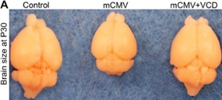 Mouse Brain Sizes